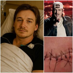 Morgan Wallen Shares Emotional Update After Surgery: “I’m Fighting, But I Can’t Do It Alone”