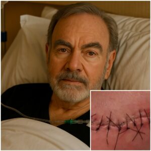 Good News from Neil Diamond: A Heartfelt Message After Surgery