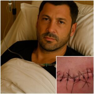 Maksim Chmerkovskiy Shares Emotional Health Update After Surgery: “I’m Fighting, But I Can’t Do It Alone”