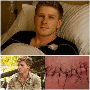 Robert Irwin Health Update: Heartfelt Message After Surgery Inspires Fans Worldwide