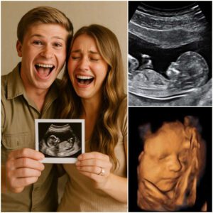 Robert Irwin’s Shock Baby Announcement Sends Fans into Meltdown as Emotional Ultrasound Reveal Sparks Global Wave of Love and Questions -du