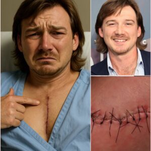 MORGAN WALLEN BREAKS HIS SILENCE WITH A SHOCKING, HEART-POUNDING MESSAGE AFTER WEEKS OF DISAPPEARING — A TRUTH SO INTENSE IT LEAVES FANS BREATHLESS AND BEGGING FOR ANSWERS - Tyta